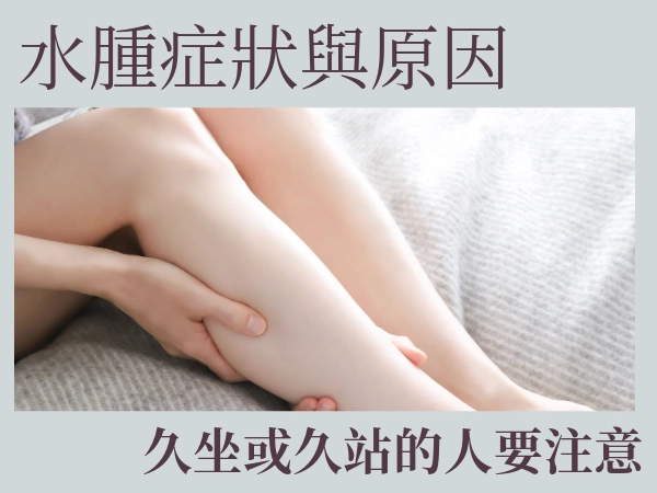 我不是胖，是水腫！這「腫」煩惱我懂，趕快來看看水腫怎麼辦