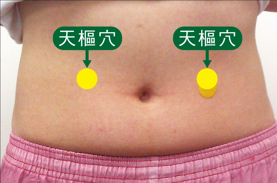 天樞穴位置示意|按壓天樞穴促進腸道蠕動、幫助排便