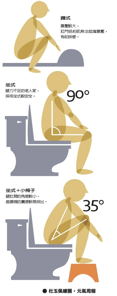 腳凳法示意圖|膝蓋高於臀部可讓肛直角變直,提升排便順暢度